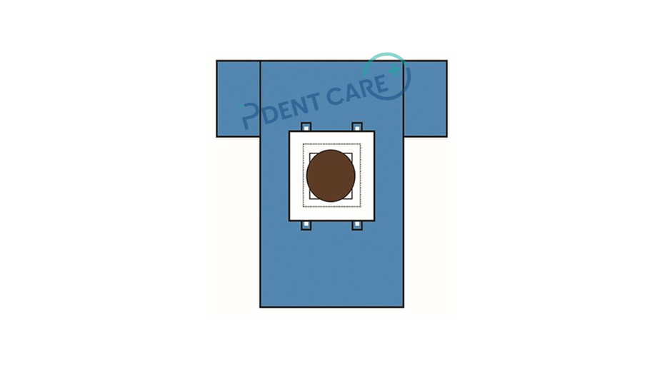 Caesarean Drape from a angiopack manufacturer in Malaysia.